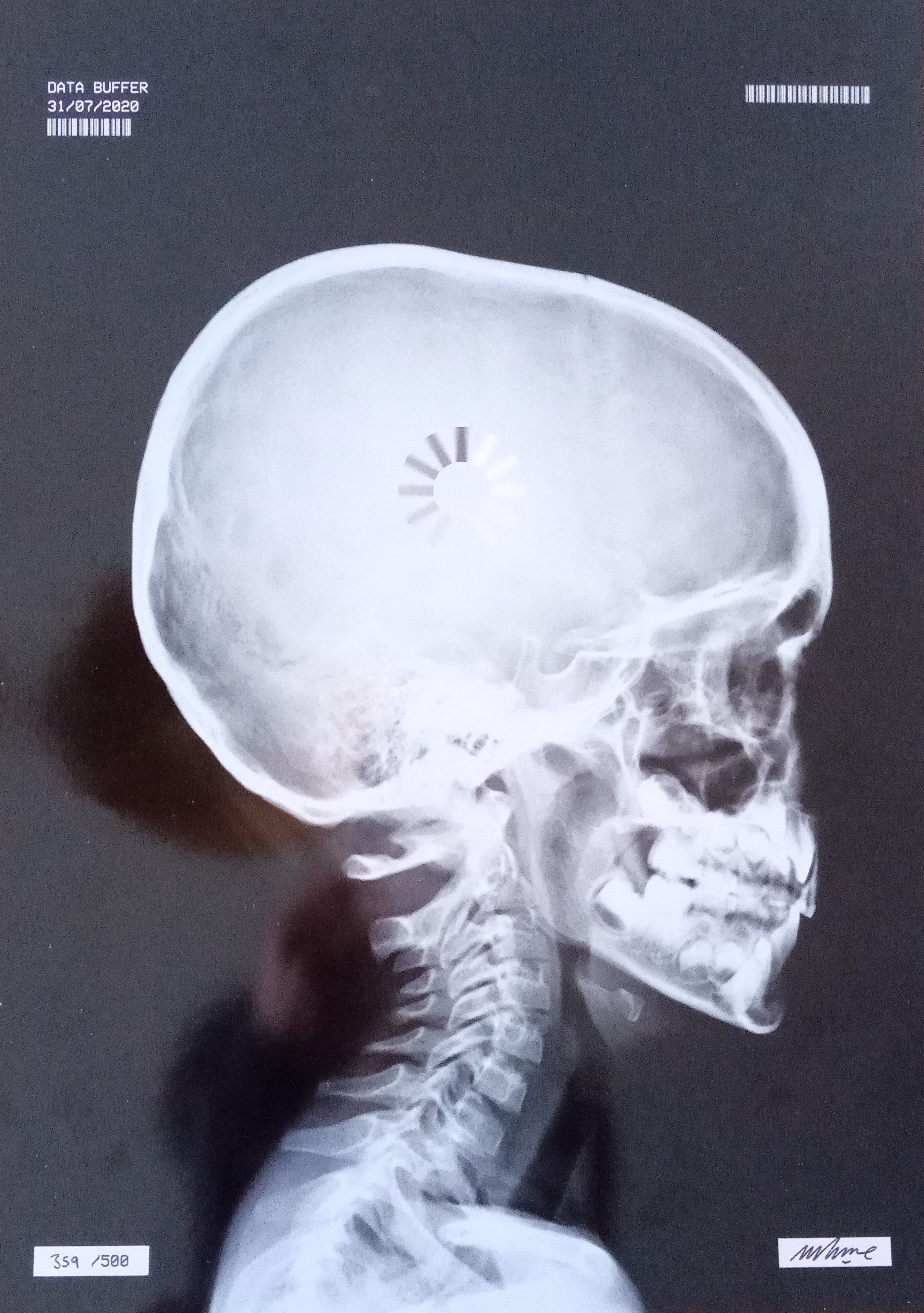 Imbue, X -Ray Imbue, X -Ray