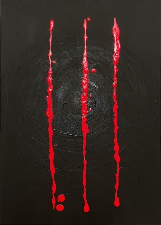 Dervis Akdemir, Survival desire Dervis Akdemir, Survival desire