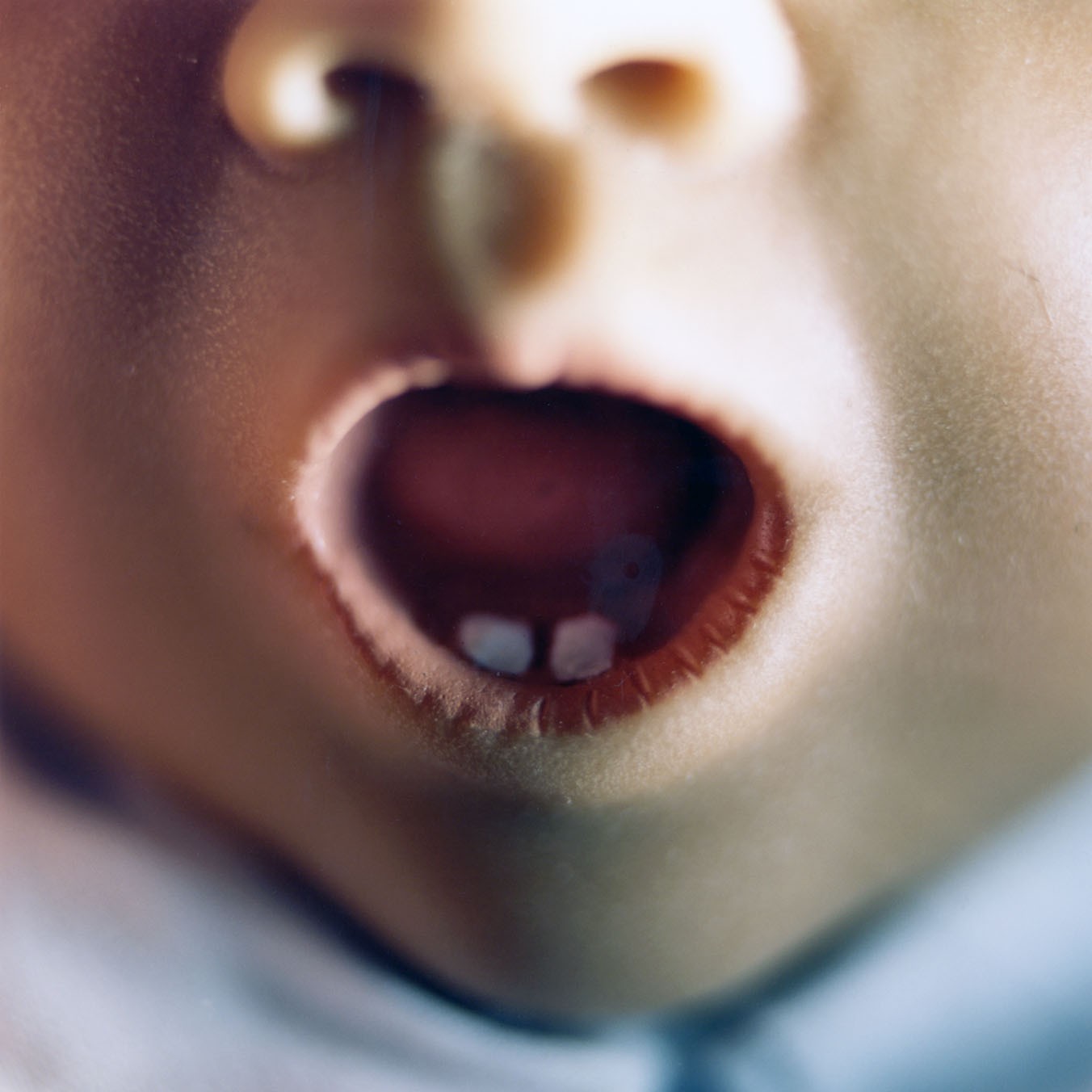 Diana Thorneycroft, Doll mouth (boy with teeth) Diana Thorneycroft, Doll mouth (boy with teeth)