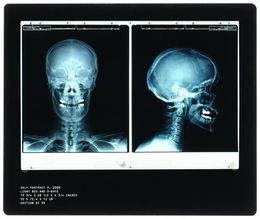 Fotografia, Self Portrait R, Damien Hirst