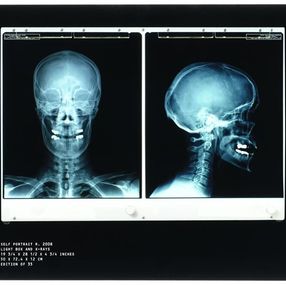 Fotografia, Self Portrait R, Damien Hirst