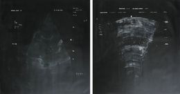 Peinture, Number 93 and 4, Diptych, Sergio Bazan