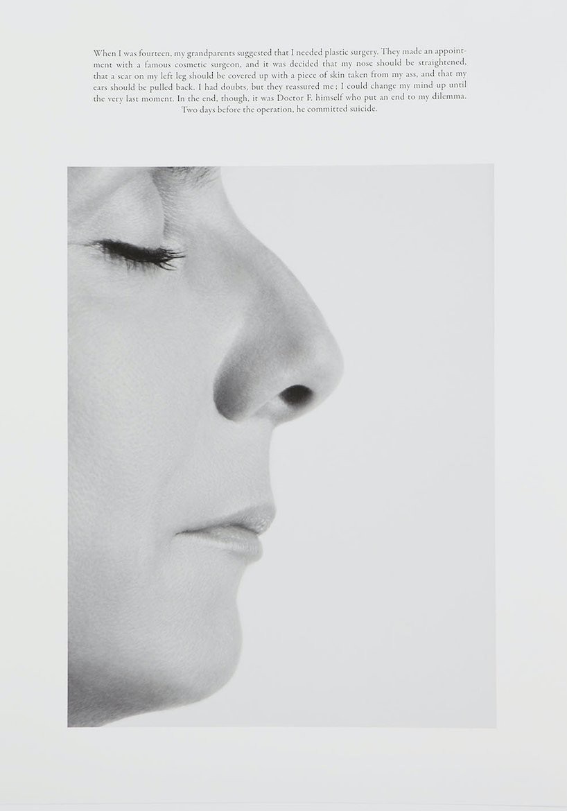 Sophie Calle, The plastic surgery En Sophie Calle, The plastic surgery En