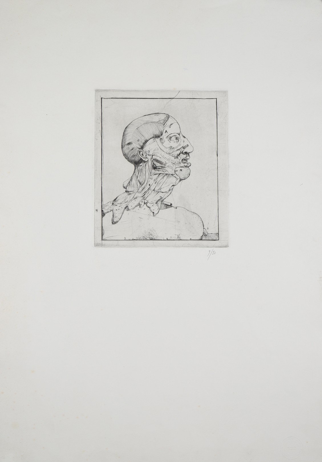 Stéphane Mandelbaum, Sans-titre (Anatomie, tête) Stéphane Mandelbaum, Sans-titre (Anatomie, tête)