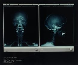Print, Poisons - Self Portrait X-Ray, Damien Hirst