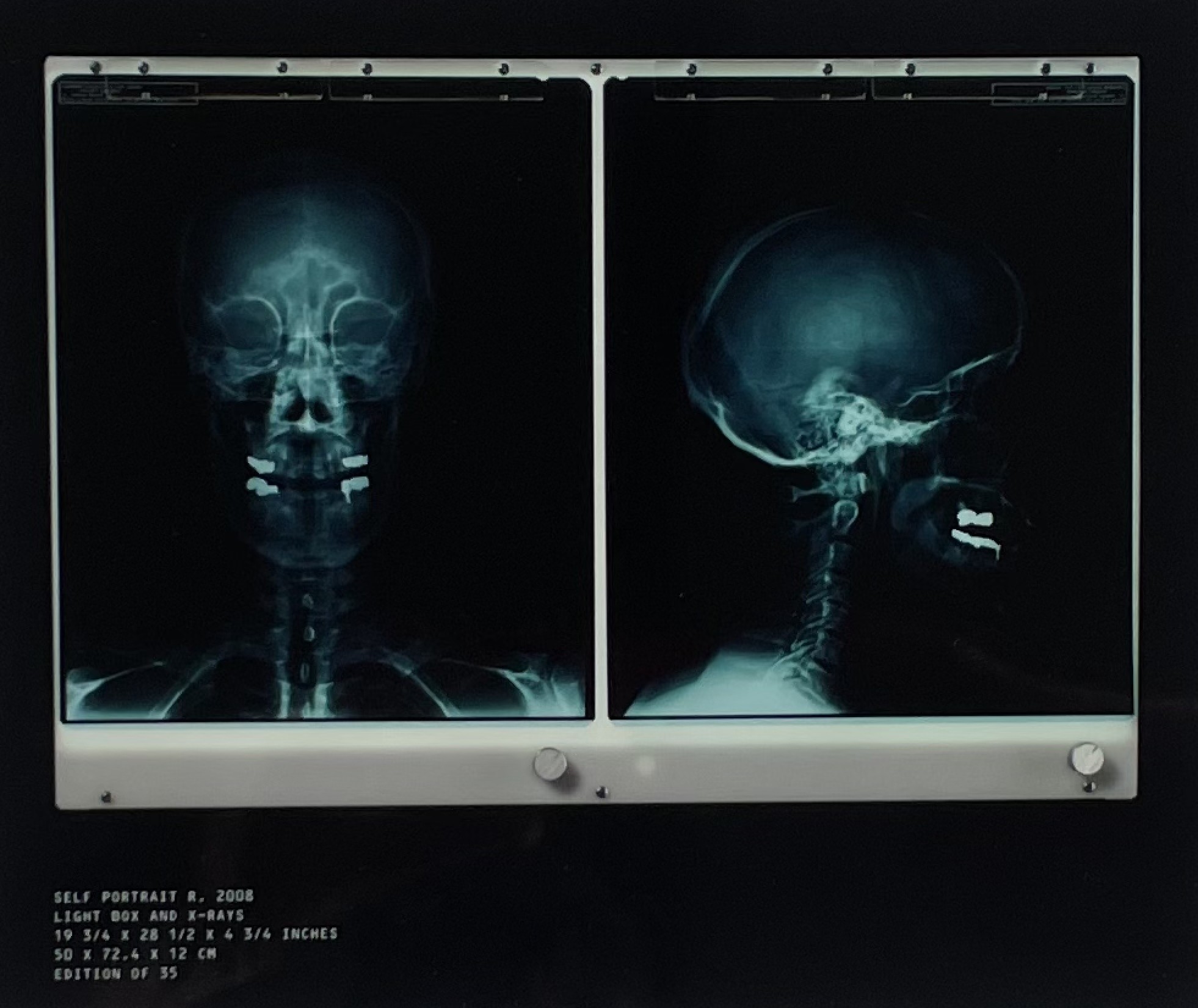 Damien Hirst, Poisons - Self Portrait X-Ray Damien Hirst, Poisons - Self Portrait X-Ray