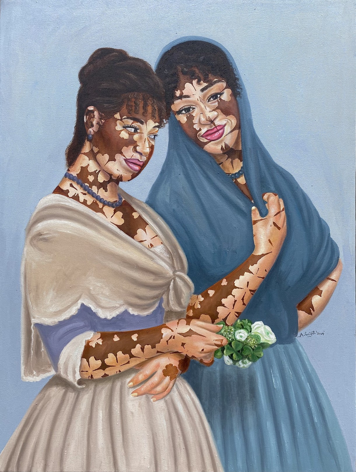 Ganiyat Abdulazeez, Beautiful Vitiligo Ladies Ganiyat Abdulazeez, Beautiful Vitiligo Ladies