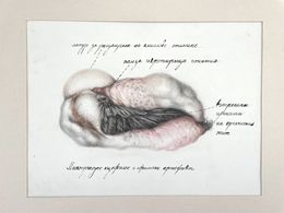 Dessin, Multipass acephalic and aphallic artifact, Radoslav Maglov