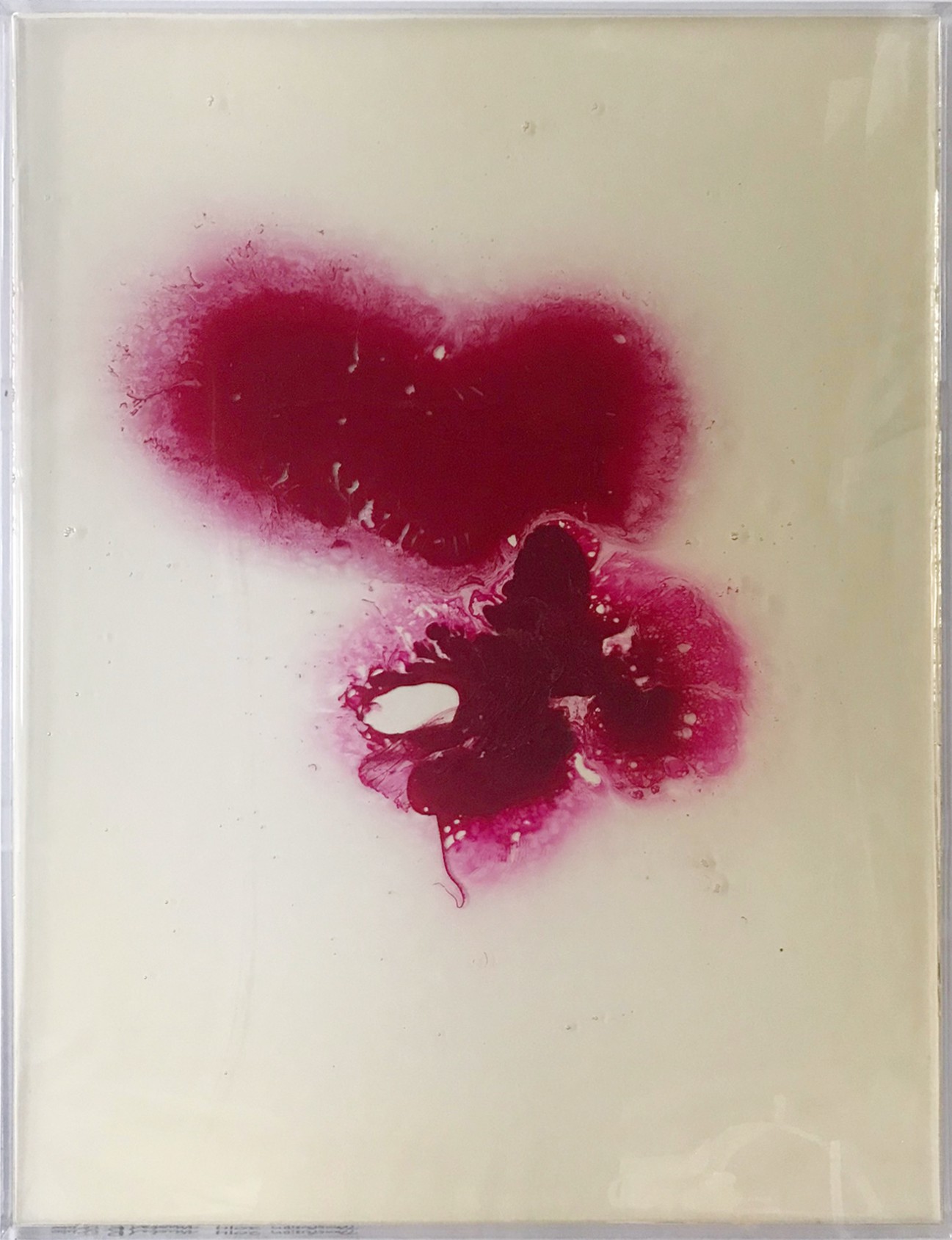 Michael Grine, Transfusion Michael Grine, Transfusion