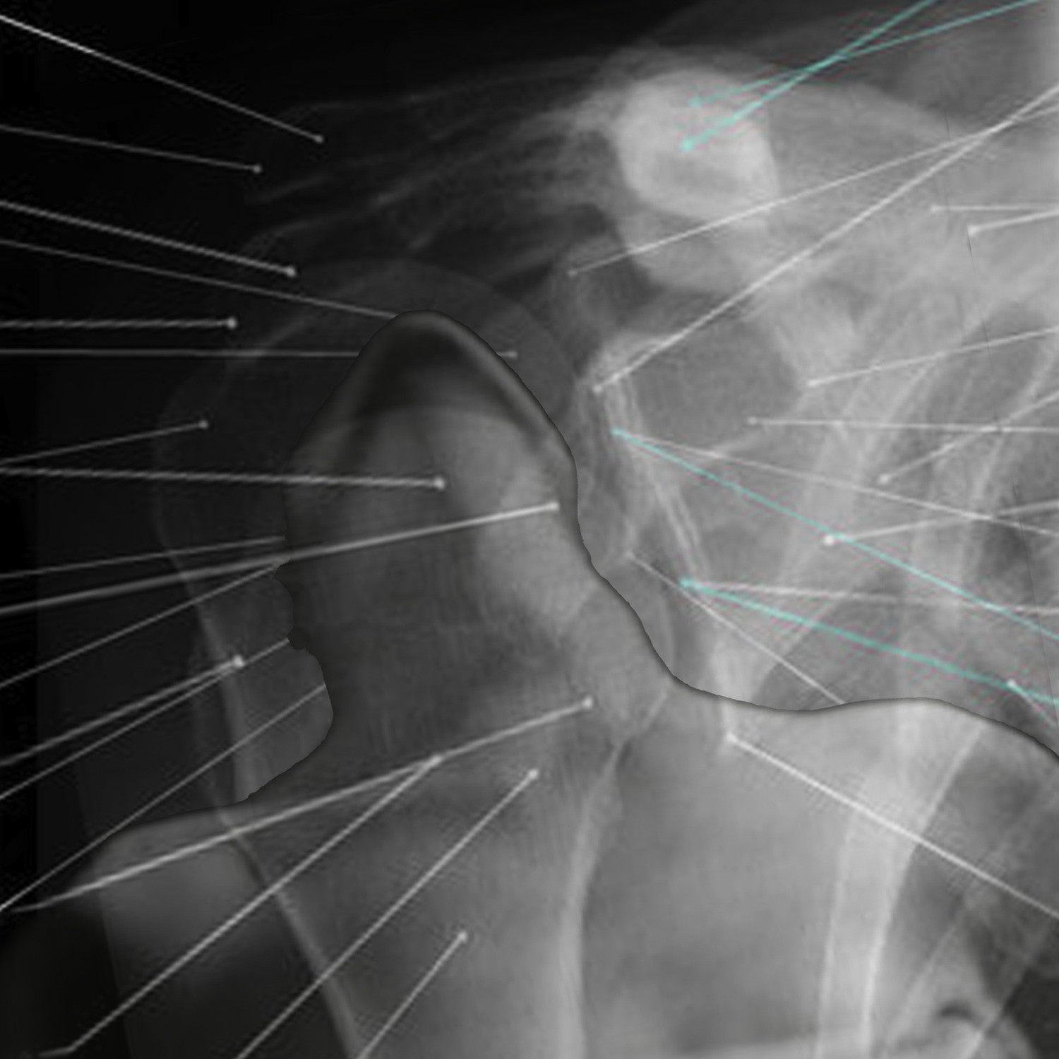 LN Le Cheviller, Anatomie d'une amnésie LN Le Cheviller, Anatomie d'une amnésie